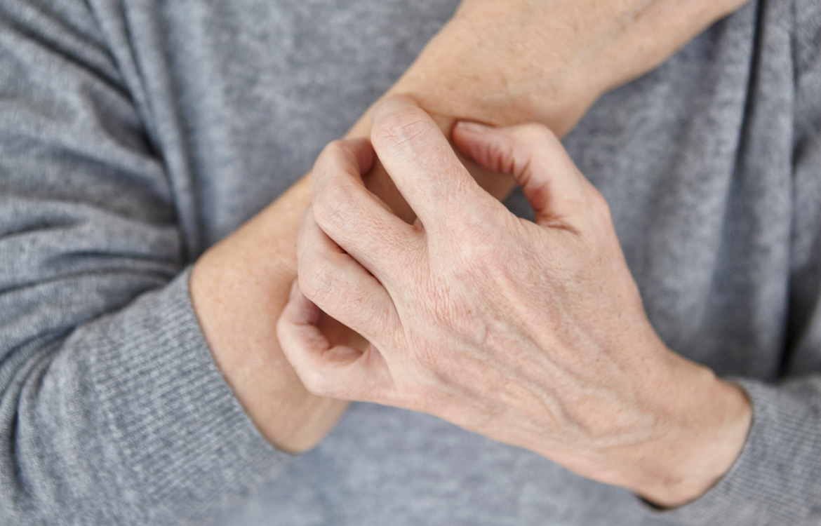 elderly person scratching arm