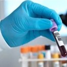 Inflammation MPO Marker