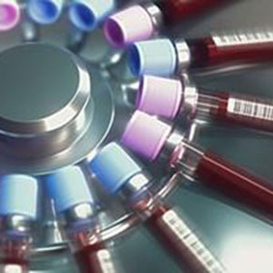 Multi cancer early detection