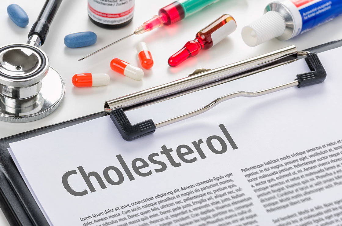 You May Need More than Just a Cholesterol Test to Determine Your Risk for Heart Disease