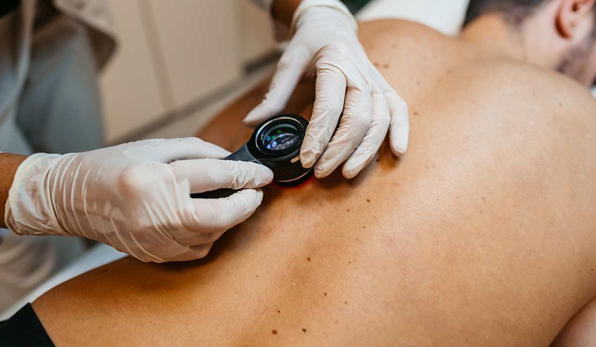 A dermatologist looks at a possible cancer spot on a patient's skin. 