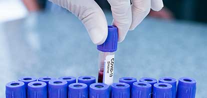 Frequently asked questions about COVID-19 treatment