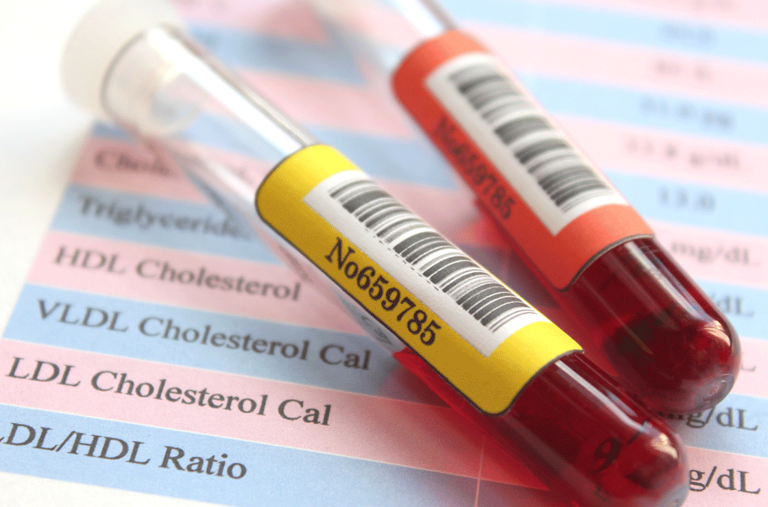 What Triglycerides Are & How to Lower Them, and 7 Cholesterol Questions Answered
