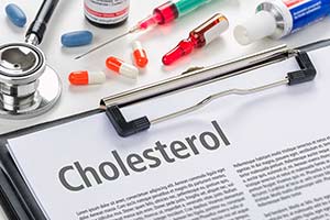 Cholesterol-Myths