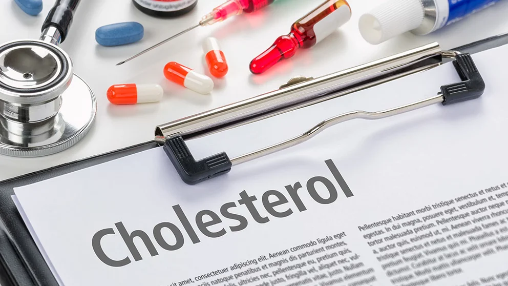 You May Need More than Just a Cholesterol Test to Determine Your Risk for Heart Disease