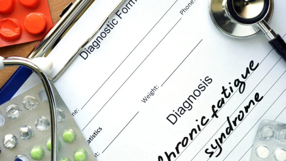 What Causes Chronic Fatigue Syndrome?