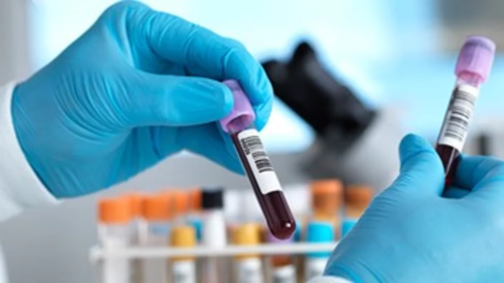Inflammation Marker Laboratory