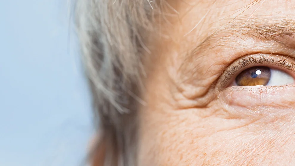 aging skin stress causes