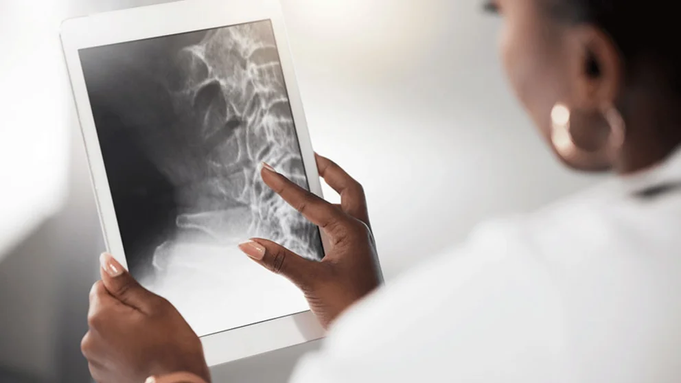 Physician reviewing xray
