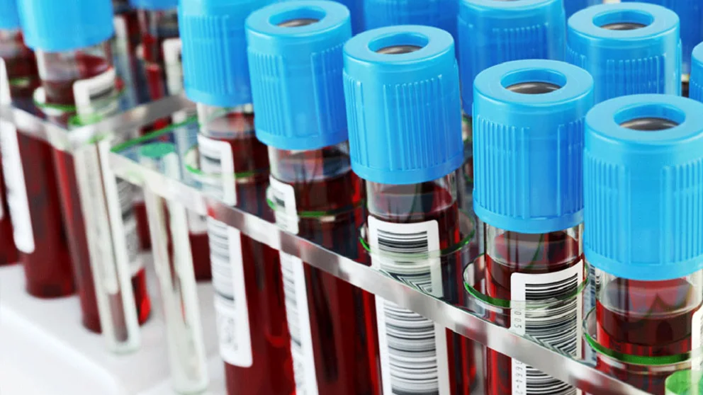 Vials of blood