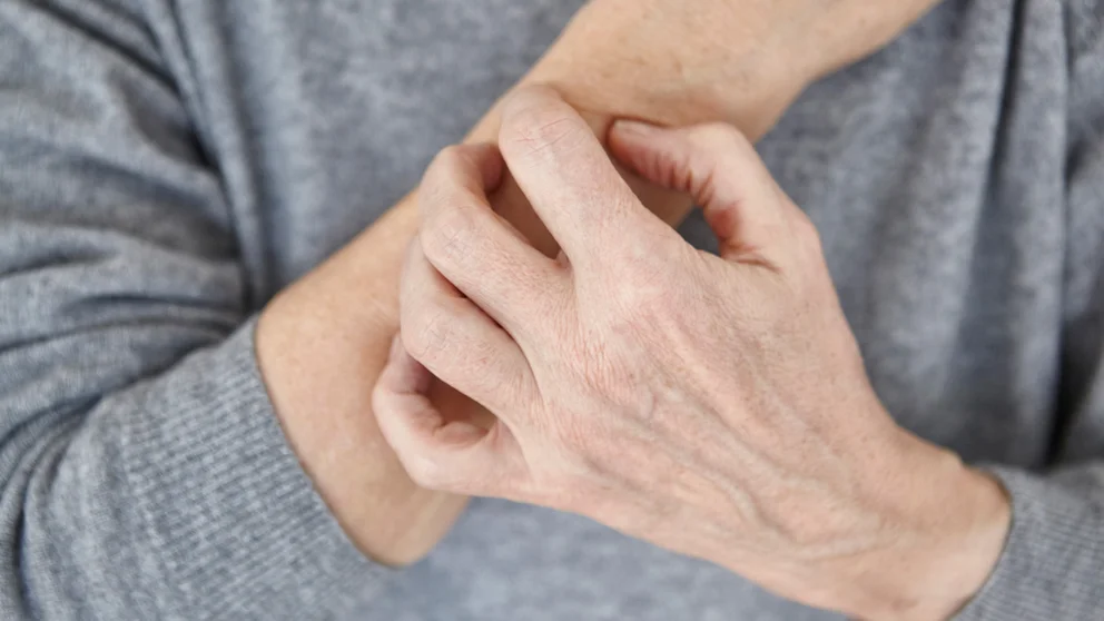 elderly person scratching arm