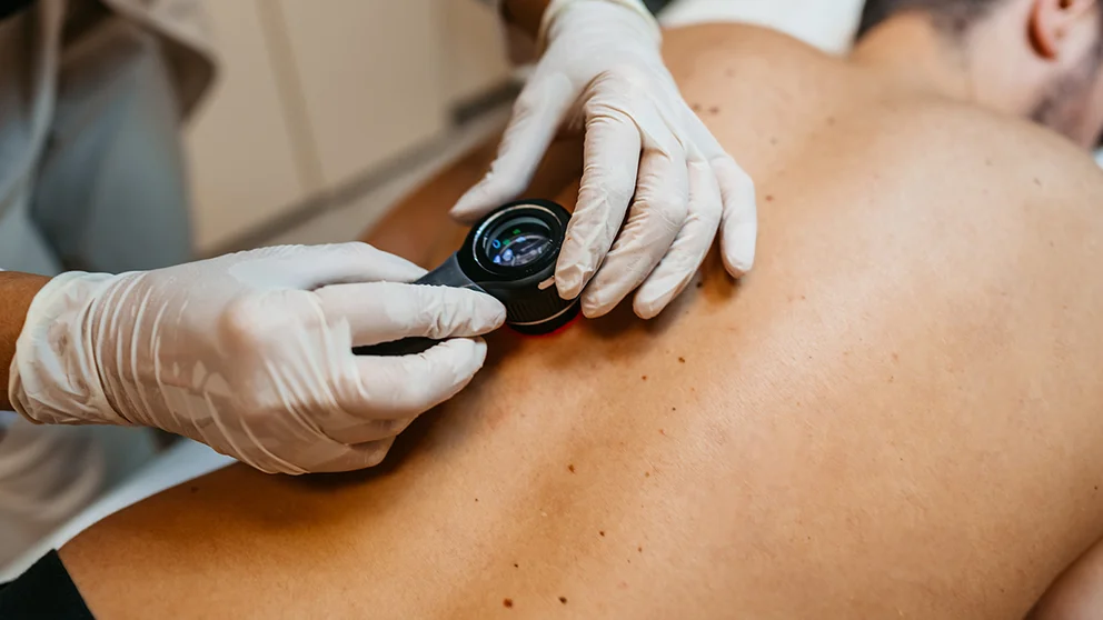 A dermatologist looks at a possible cancer spot on a patient's skin. 