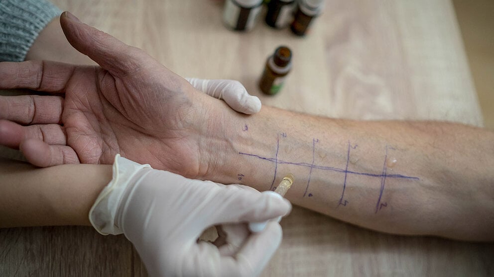 food-allergy-testing