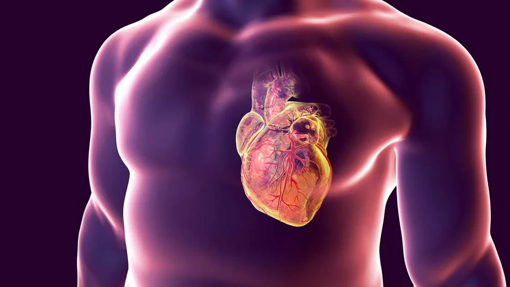 What Happens During a Heart Attack