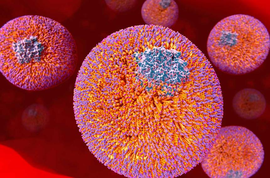 Focus Less on Cholesterol Screenings and More on These 3 Tests