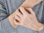 elderly person scratching arm